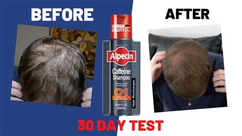 Alpecin Review .